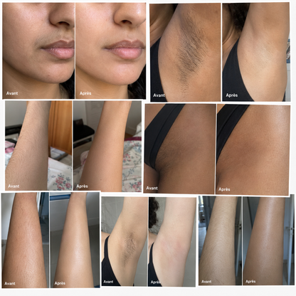 ☀️ SUMMER GLOW KIT™ | Kit Épilation Sans Bande Complet